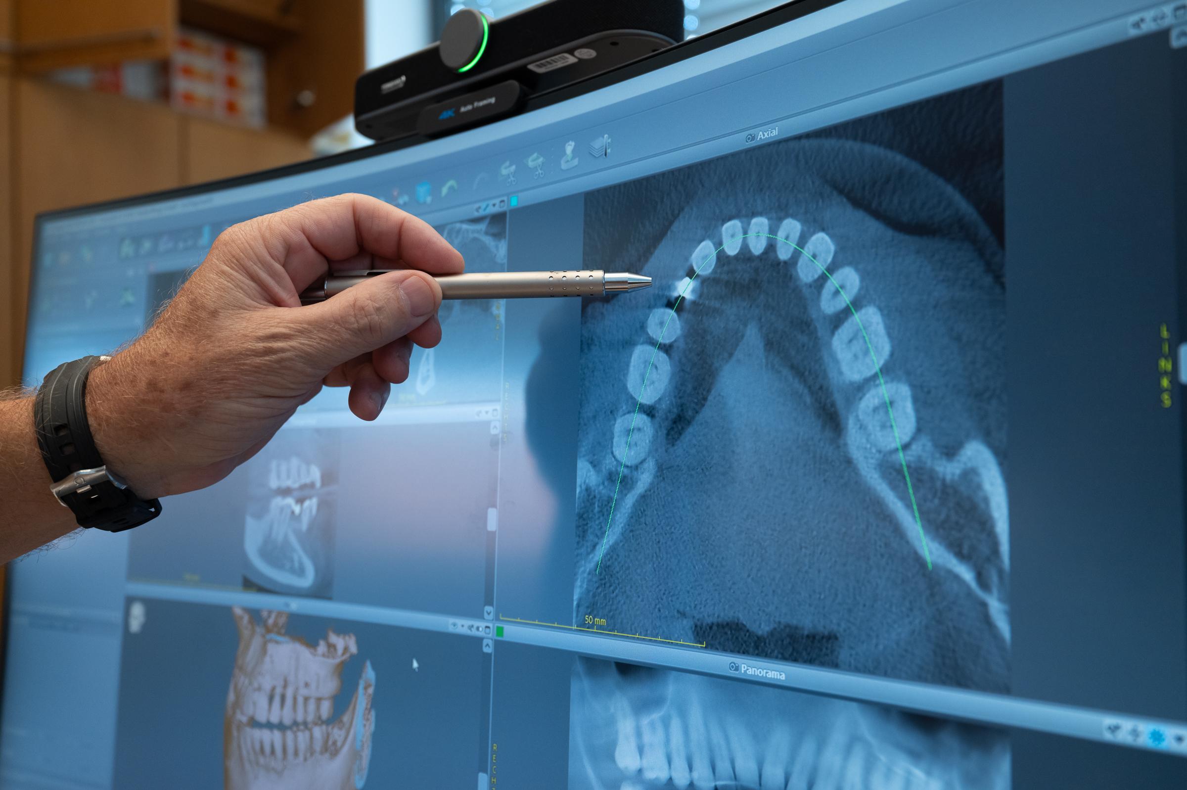 Periimplantitis-Sprechstunde