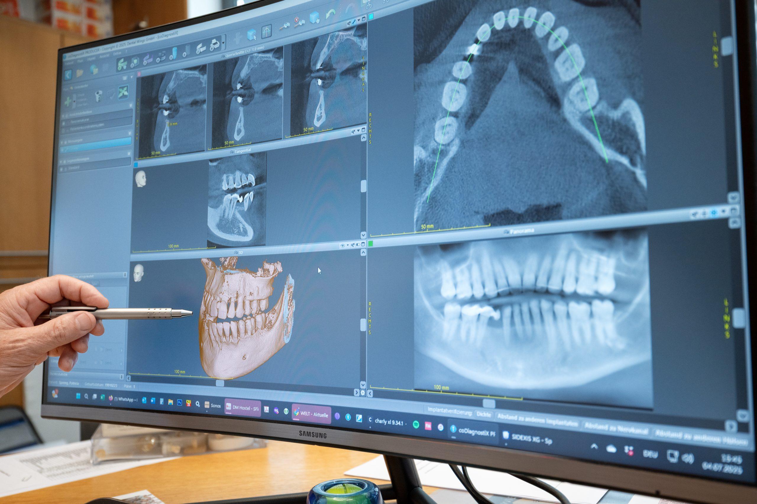 Gesunde Implantate erhalten